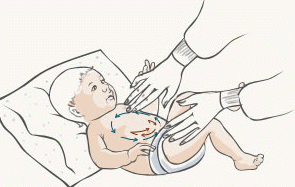 colic in infants what to do