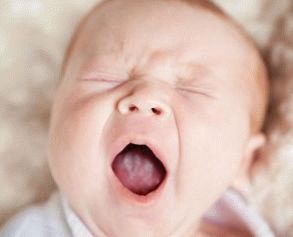 mengapa bayi yang baru lahir mempunyai lidah putih