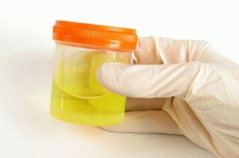 troebele urine bij een baby