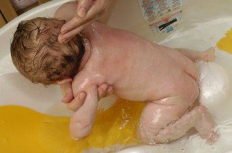 Efter varje avföring är det nödvändigt att tvätta barnet, torka huden och behandla vecken med talkpulver eller babykräm.