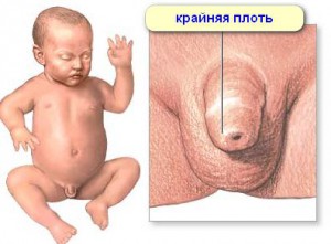 hygiène intime des garçons nouveau-nés