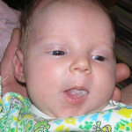 Foto av trost hos nyfødte i tungen