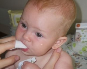 hoita munasolua vastasyntyneen suussa