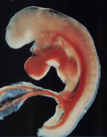 Foto do embrião na 4ª semana