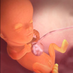 11 haftalık fetus