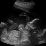 foto ad ultrasuoni