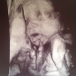 foto-ultrazvuk-27-tjedana