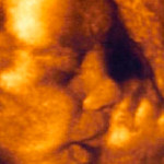 Ultrason bebek emmek parmak