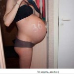 foto-mide-at-36 haftalık ikiz
