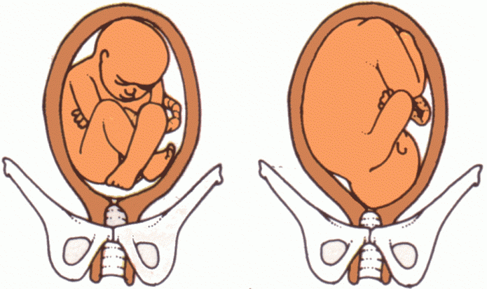 παρουσίαση του εμβρύου