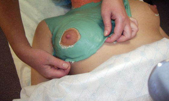 masker för bröstlyftning