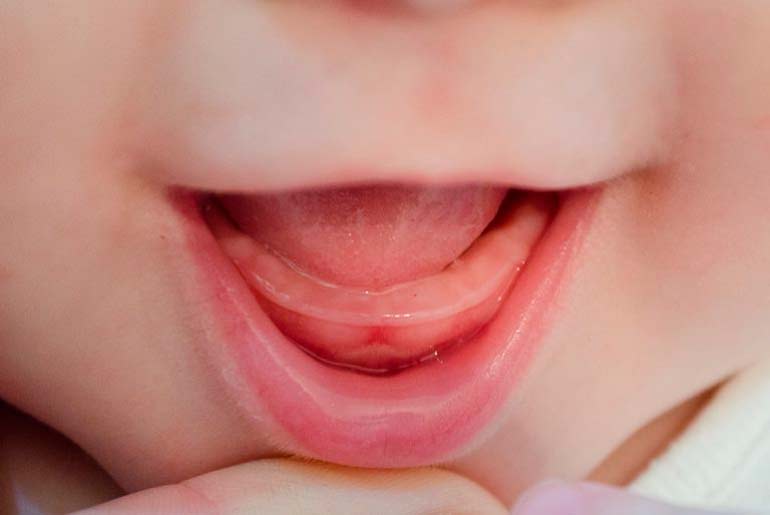 barnets tänder skärs